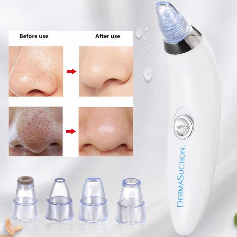 Derma Suction Pore Cleaning Device With Vacuum Action Face Pore Cleaner Facial Beauty Equipment 4 in 1 Black Head Remover - Online Shopping in Pakistan: Beauty, Fashion, Electronics, Sports & Lifestyle, VR, Skincare